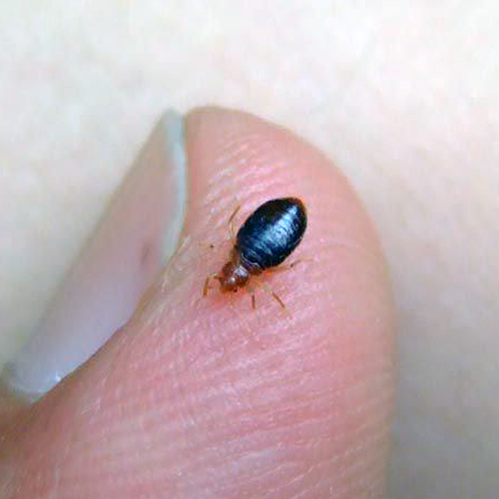 bedbug on finger